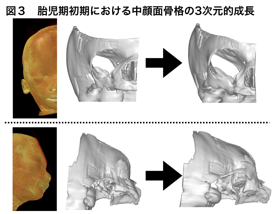 顔面先天異常に関する基礎研究 京都大学医学部附属病院 形成外科